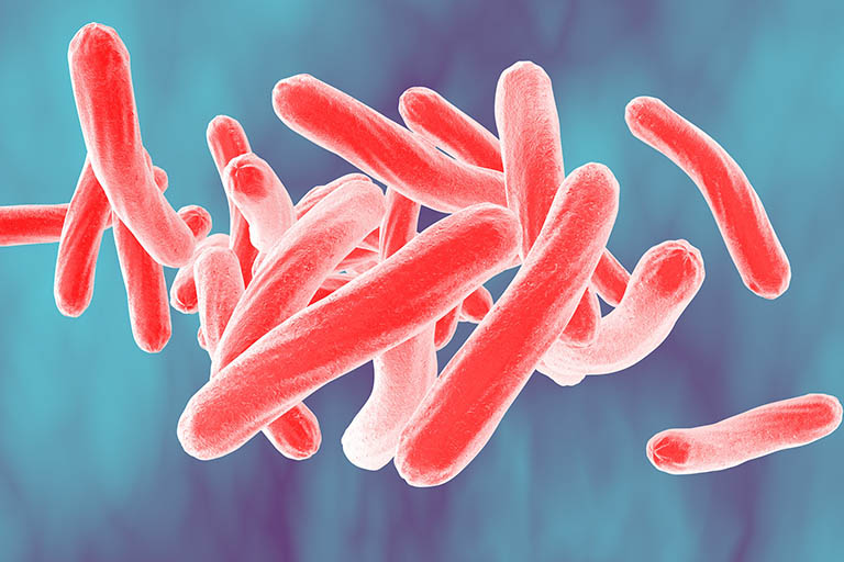 Trực khuẩn lao Mycobacterium tuberculosis là nguyên nhân chính gây bệnh lao xương