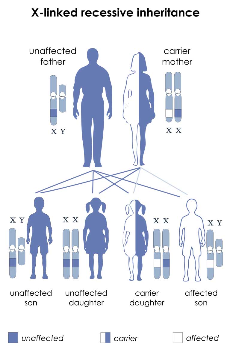 Gen nằm trên X nhiễm sắc thể và kiểu hình di truyền lặn liên kết X