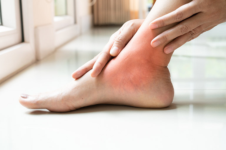 lợi ích của sữa cho người bị gout