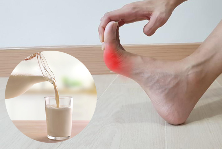 Tác dụng của sữa đối với bệnh gout