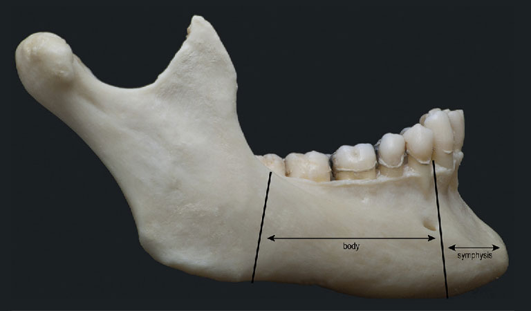 Giải phẫu xương hàm dưới