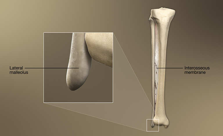 Phần xa của xương mác tạo nên mặt bên của mắt cá chân