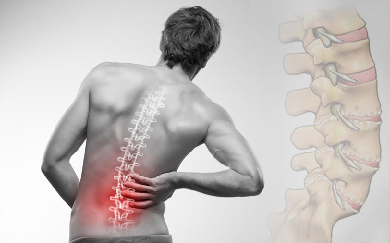 đau thắt lưng ở người trẻ là bệnh gì