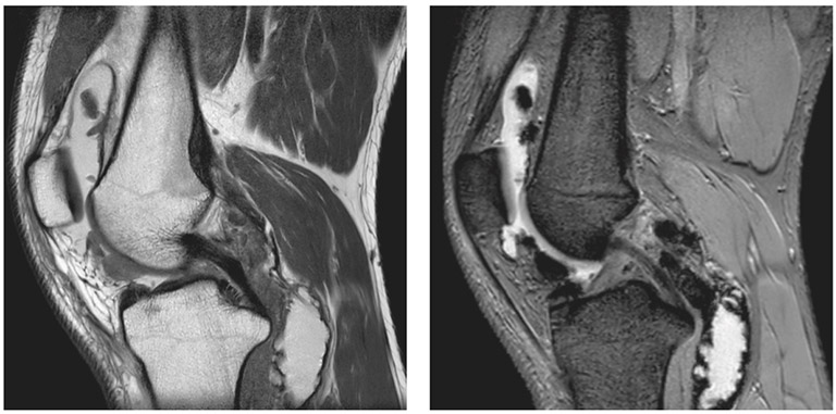 Chụp cộng hưởng từ (MRI