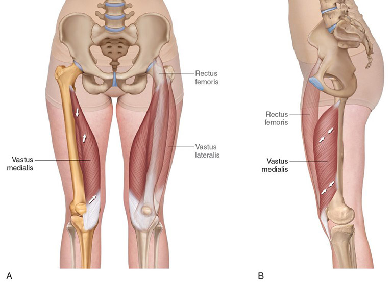 Cơ Vastus medialis