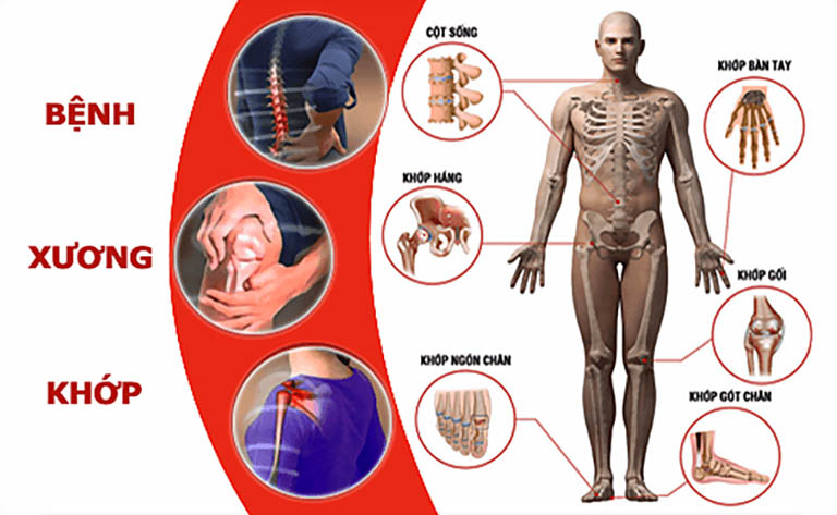 Các vị trí xương khớp dễ bị đau nhức