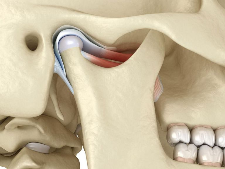 Điều trị viêm khớp thái dương hàm ở những địa chỉ uy tín để sớm khắc phục bệnh