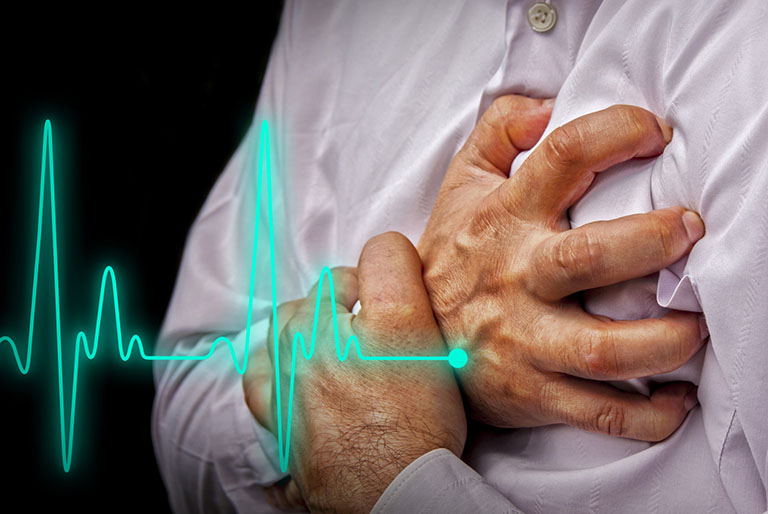 Tức ngực khó thở tim đập nhanh do bệnh lý tim mạch có thể gây đau tim và tăng nguy cơ tử vong