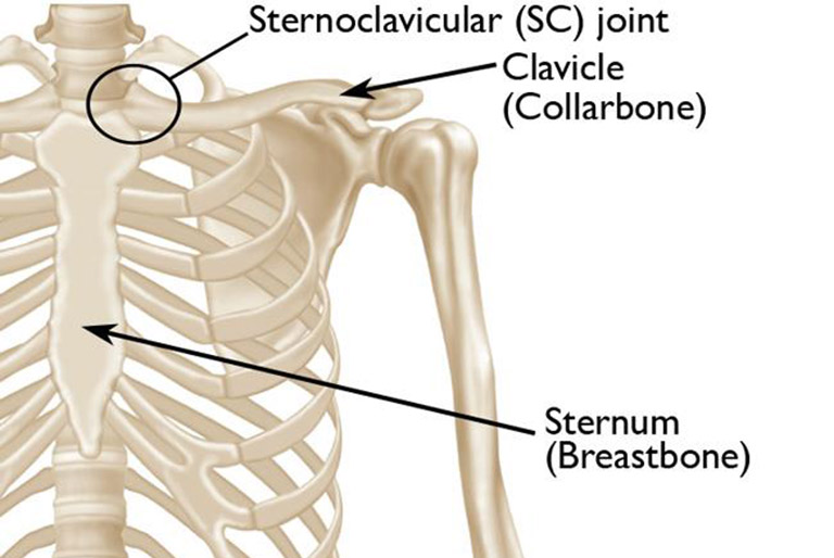 Viêm khớp ức đòn