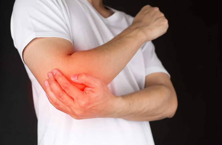 Đau khuỷu tay là triệu chứng gãy trên lồi cầu xương cánh tay