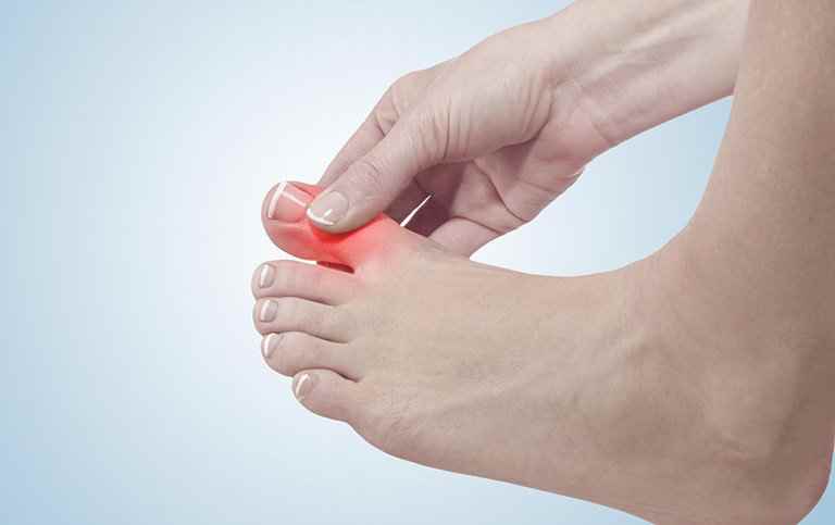 bị gout có nên ngâm chân 