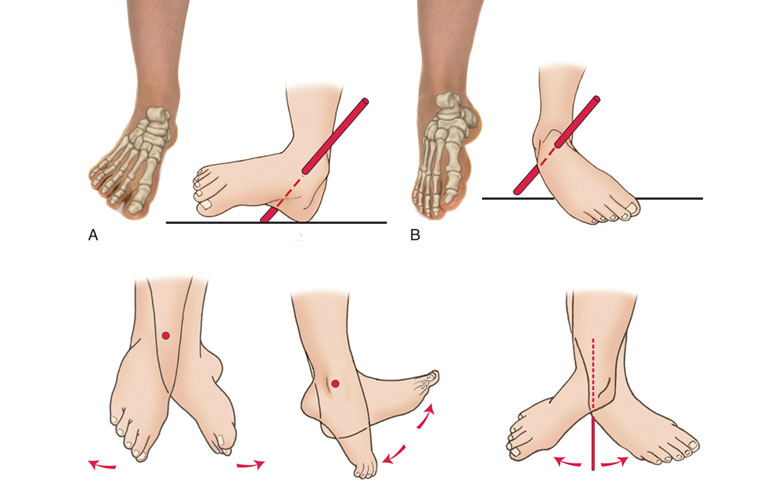 Bị viêm đa khớp dạng thấp nên tập môn gì